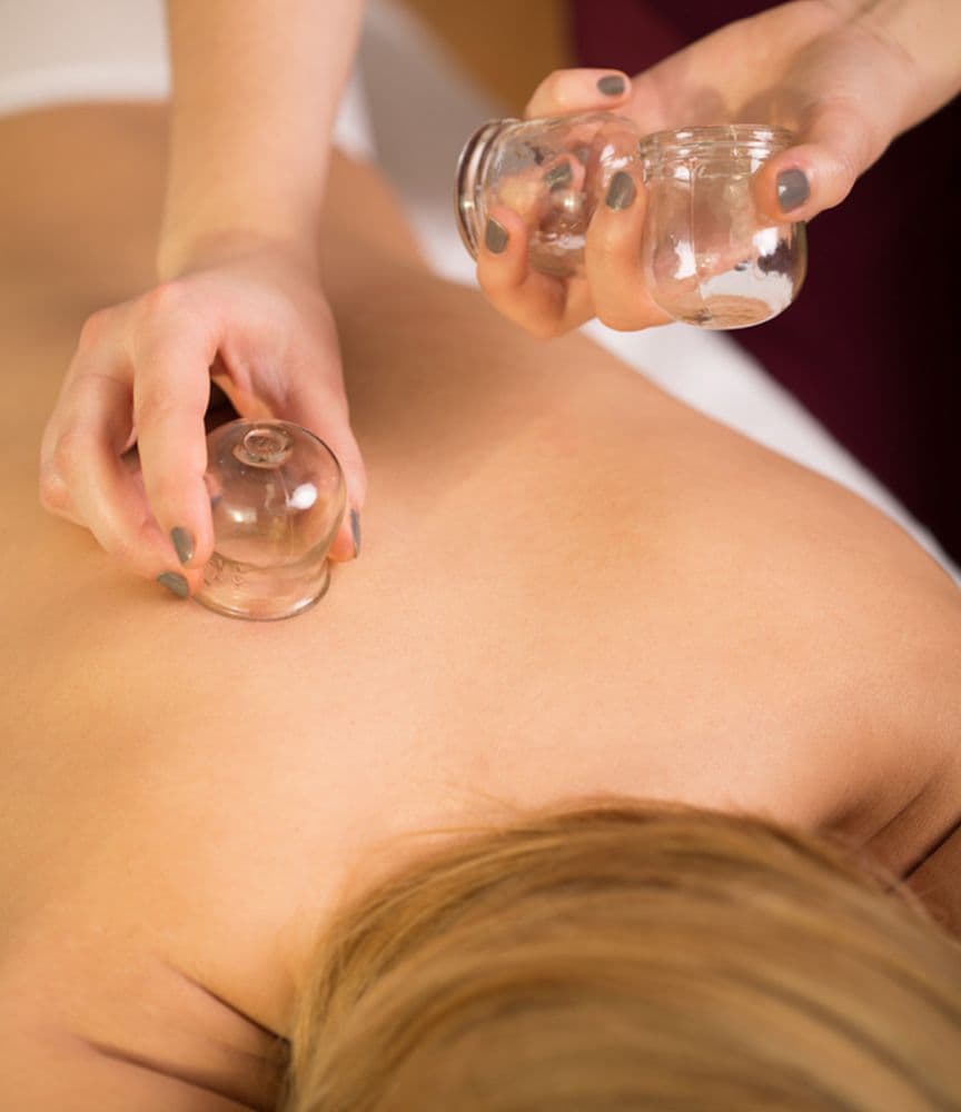 Cupping therapy on a patient's back